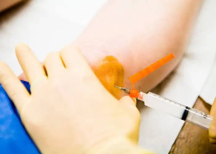 حقن الركبة الموضعية